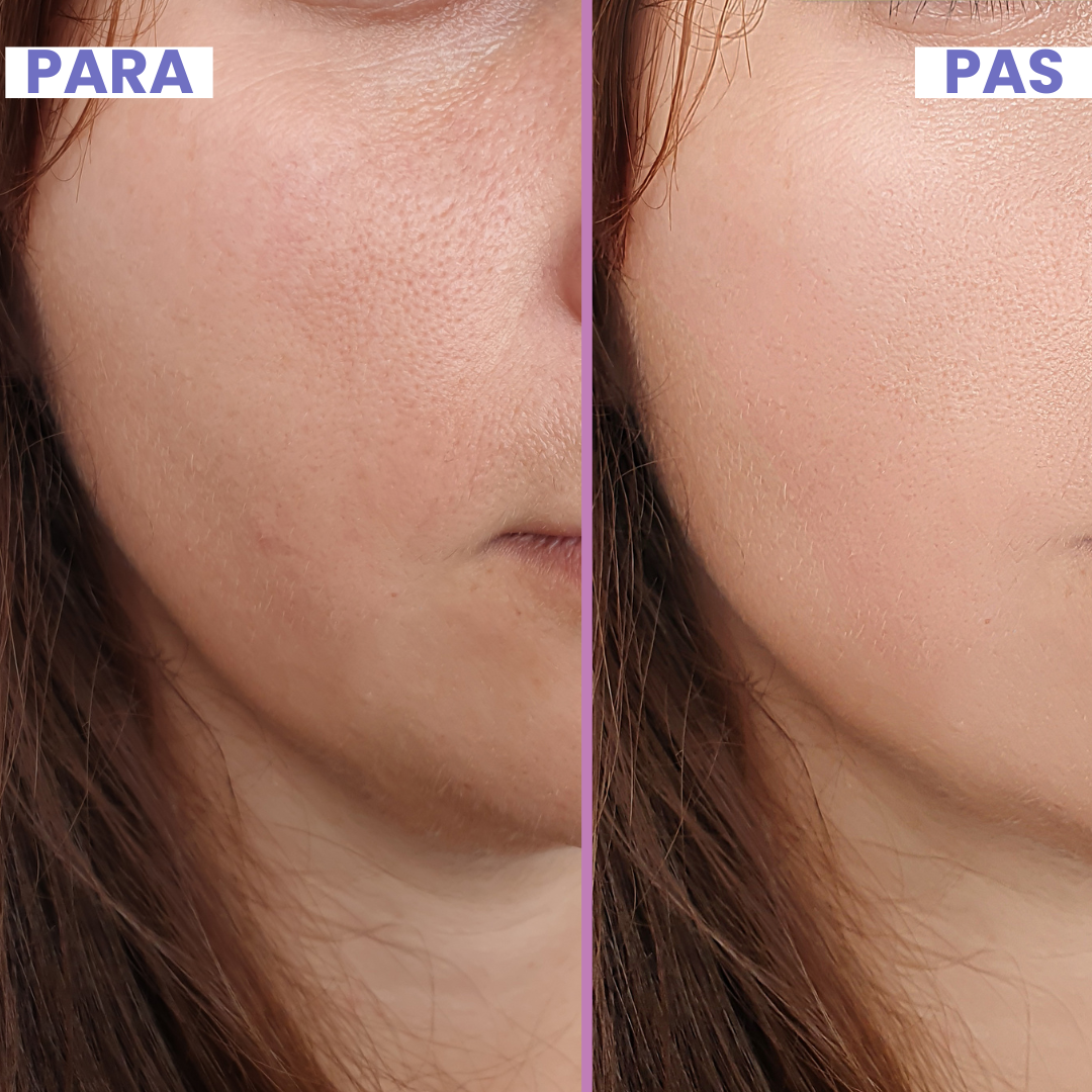 Krem me acid hyaluronik